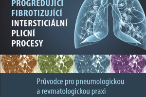 Progredující fibrotizující intersticiální plicní procesy