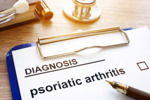 Krok k prevenci – nástroj pro odhad rizika psoriatické artritidy